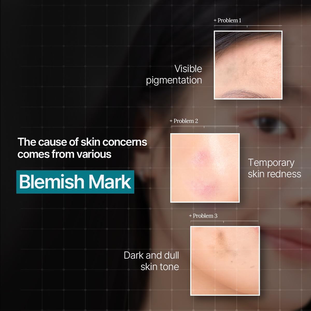 Mediheal Madecassoside Essential Mask Blemish Repair 10+1 | Koreanskincare